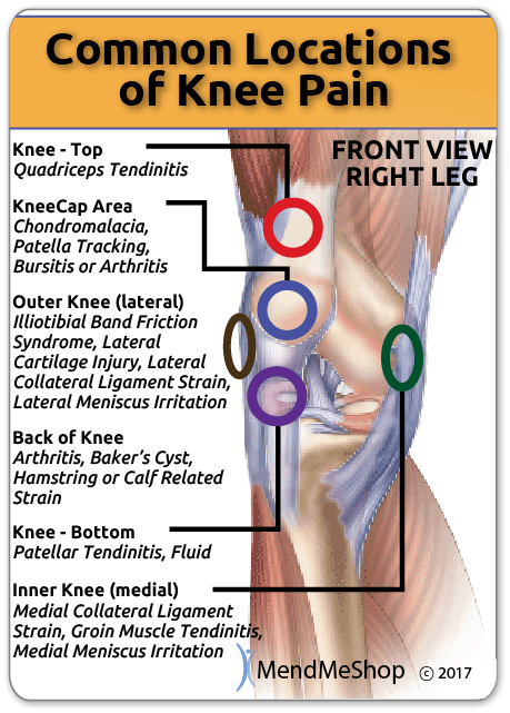 common locations of knee pain