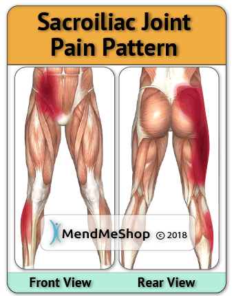 Pain pattern sacroiliac joint hip thigh quadricep