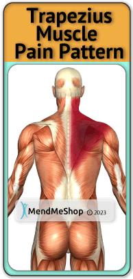 Trapezius muscle pain pattern, where trapezius hurts
