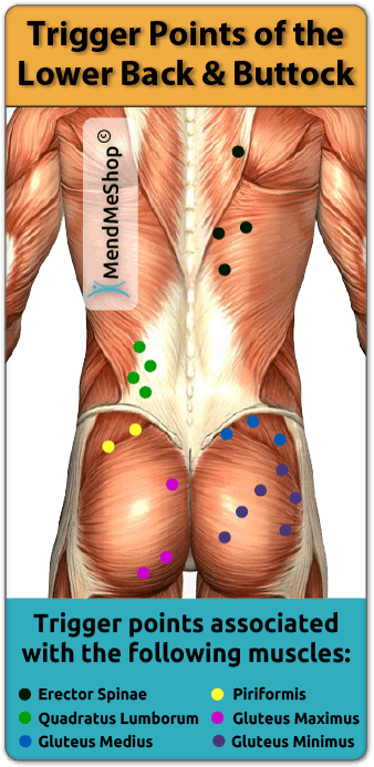 Myofascial pain trigger points lower back.