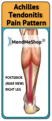achilles-heel-tendon-pain-pattern