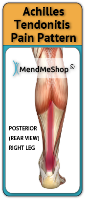 achilles tendonitis pain area