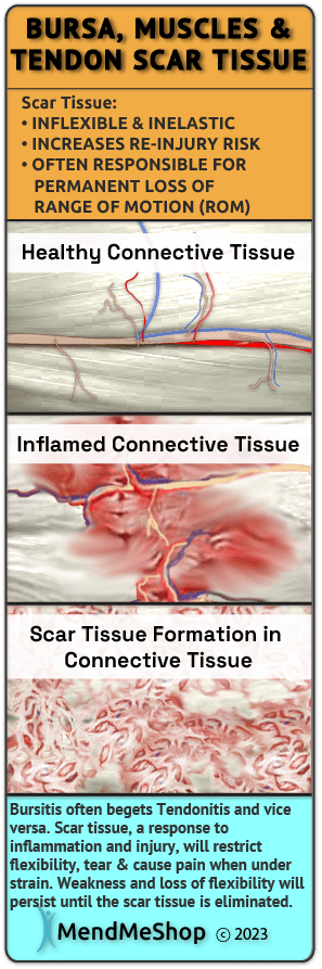 Scar Tissue Pain