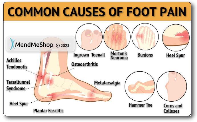 foot pain causes