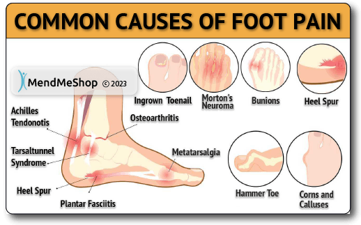 foot pain common causes