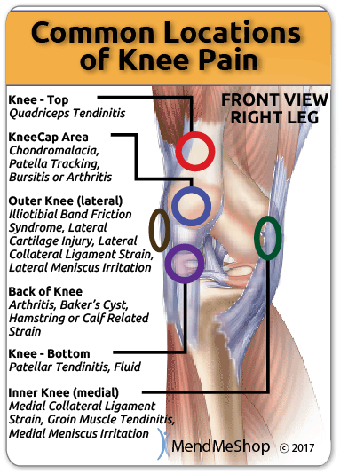 knee pain common locations