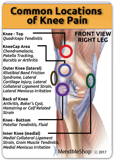 Knee Pain Common Locations