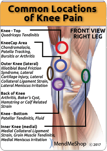 causes & locations of knee pain