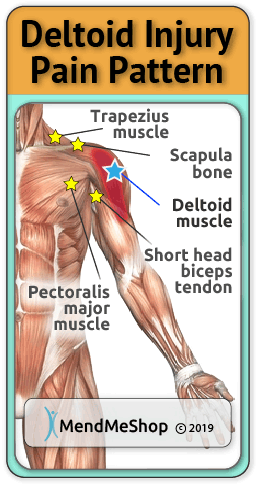 deltoid muscle strain pain pattern