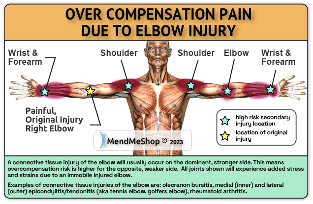 elbow injury overcompensation pain high risk regions