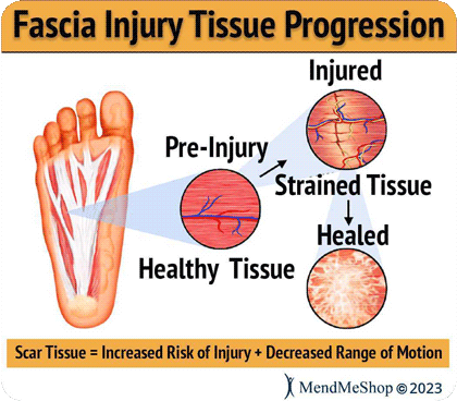 injured fascia scar tissue