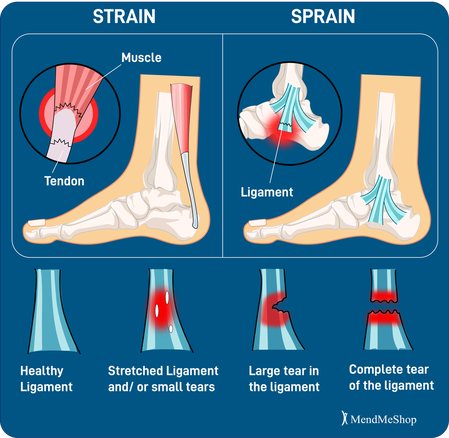 Common Conditions That Cause Foot Pain