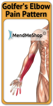 golfers-elbow-tendinosis-pain-pattern