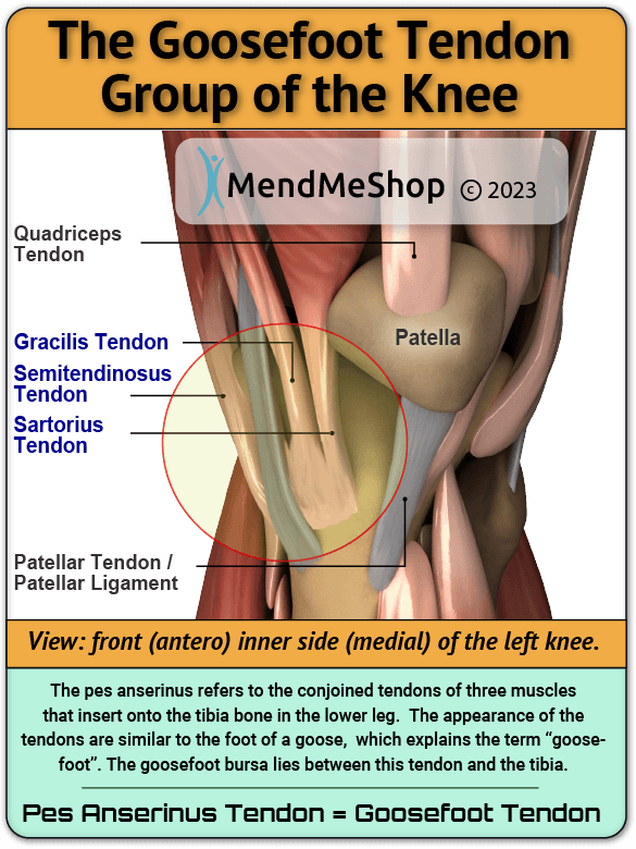 goosefoot tendonitis visual illustration