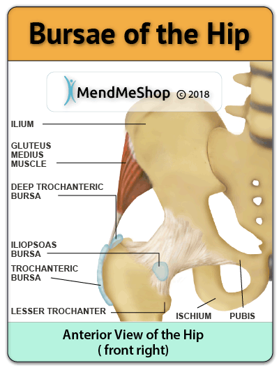 Vistasol Medical Group - What Is Hip Bursitis? #Bursitis is an  #inflammation of the fluid filled bursa sac which causes hip pain. A bursa  sac is a small, gel-like pillow that sits