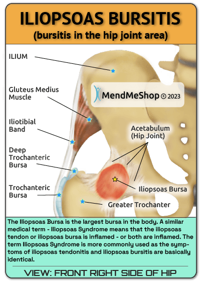 Hip Bursitis Information - Sinew Therapeutics