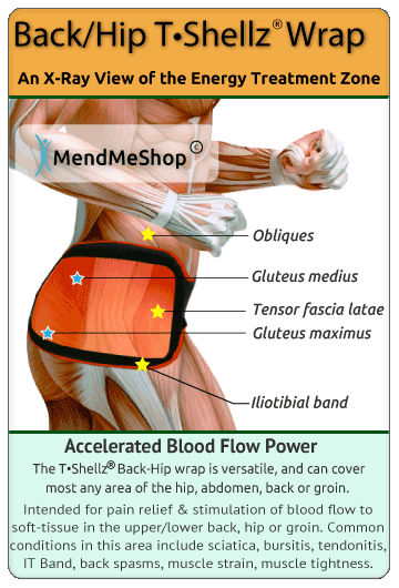 Hip Bursitis - Treatment in Burlington ON