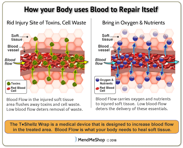 soft tissue repair via blood blow boost