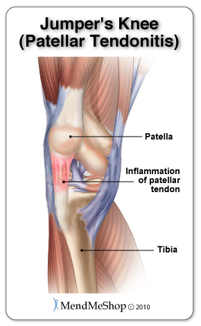 tendons and ligaments of the knee