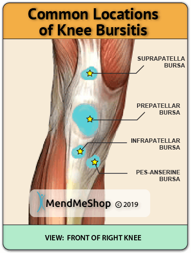 bursa sac knee