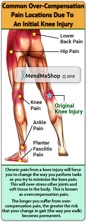 knee pain overcompensation patterns