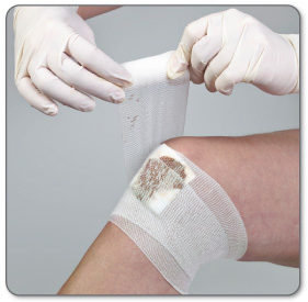 knee surgery meniscus gauze wrap