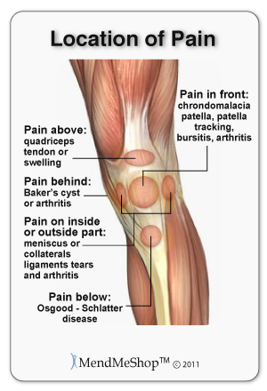 knee pain chart