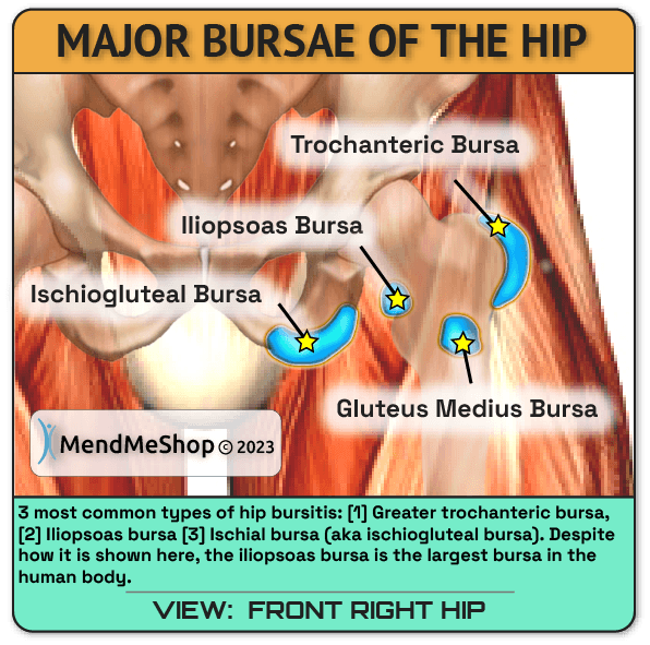 Common bursae in the hip joint and hip area.