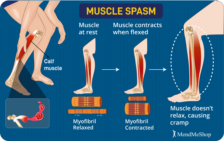 muscle-spasms-in-the-foot