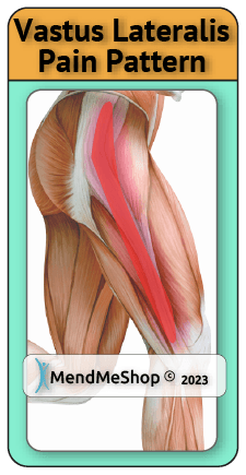 pain pattern vastus lateralis muscle hip thigh