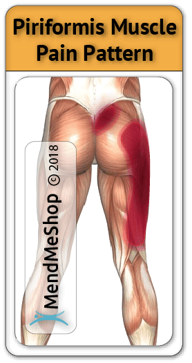 piriformis pain areas hip and leg