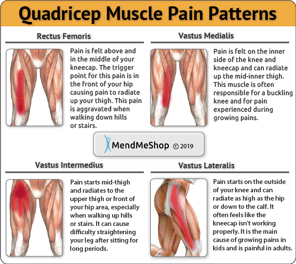common pain pattern for quadricep