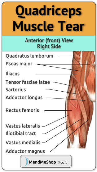 quadricep pain anatomy