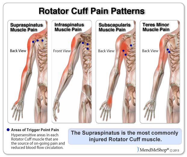 Rotator cuff store tendonitis test