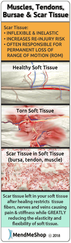 scar tissue restricts tissue fibers