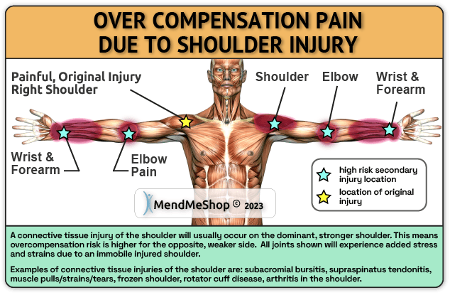 shoulder injury overcompensation pain high risk regions