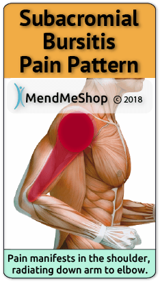 Subacromial Bursitis pain pattern.