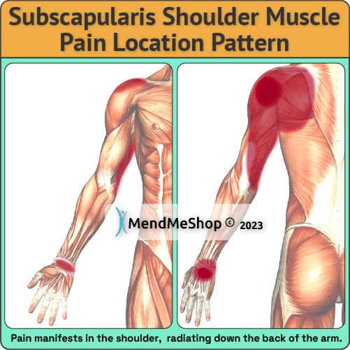 shoulder scapularis muscle pain pattern