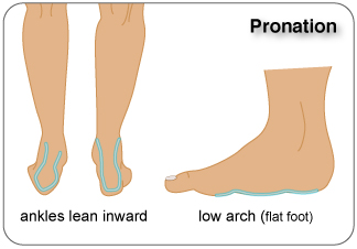 Pronation of the Foot, flat footedness