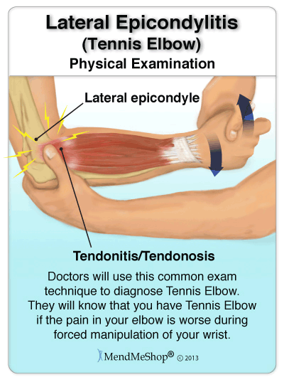 lateral epicondylitis test