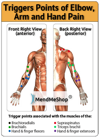 trigger points elbow hand arm