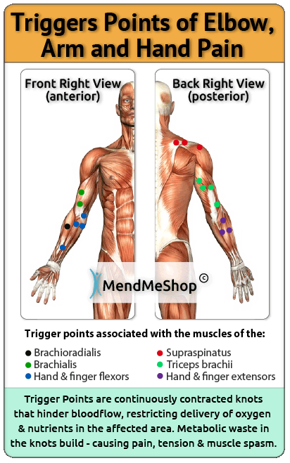 trigger point elbow arm hand