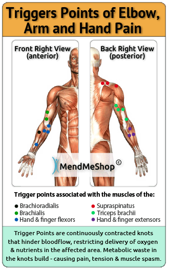 trigger points of forearm, arm, wrist & elbow