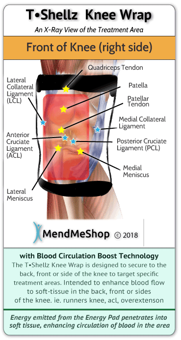 Increase blood flow to speed up healing of your radial tear of the Posterior Horn lateral meniscus.