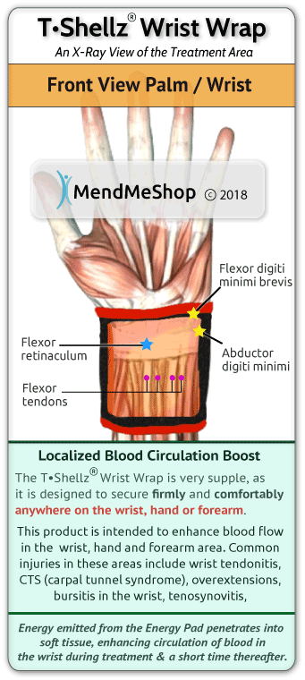 Soft Tissue Injury Wrist Recovery Time - McMath Woods P.A.